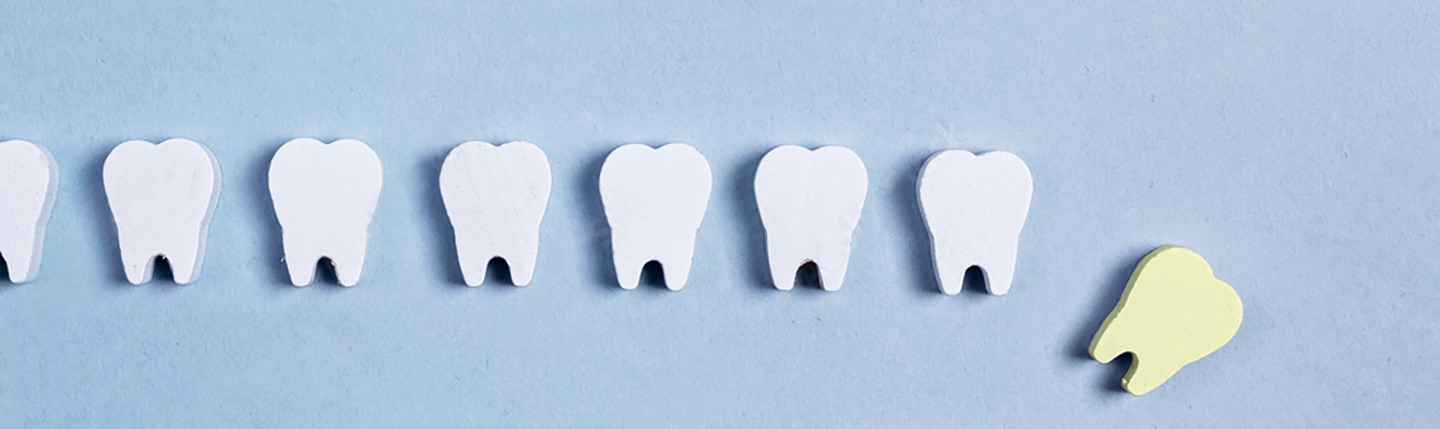 What are my options if I have missing teeth